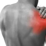 Frozen Shoulder