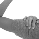 Nerve Entrapment Syndrome​